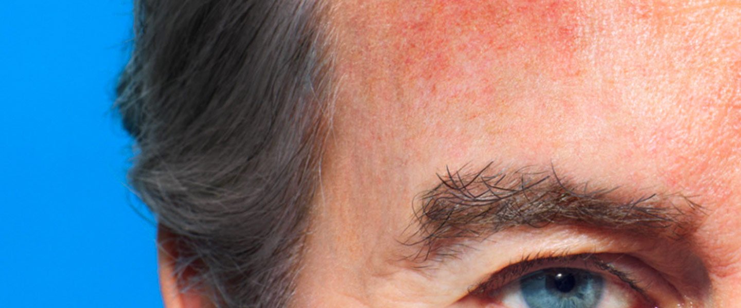 Larocheposay SubCategoryPage Damaged Burnt skin